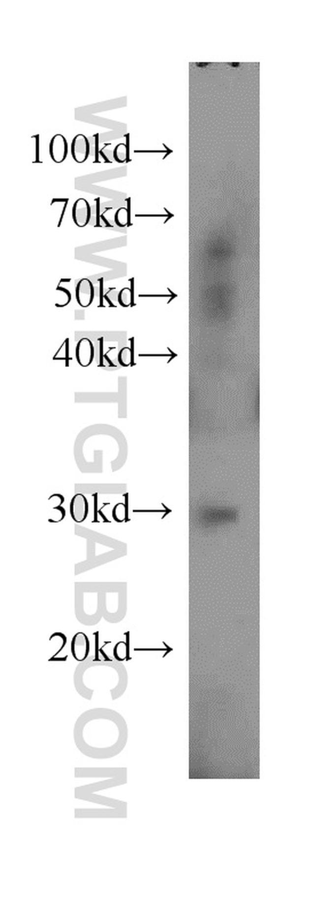 UCP2 Antibody in Western Blot (WB)