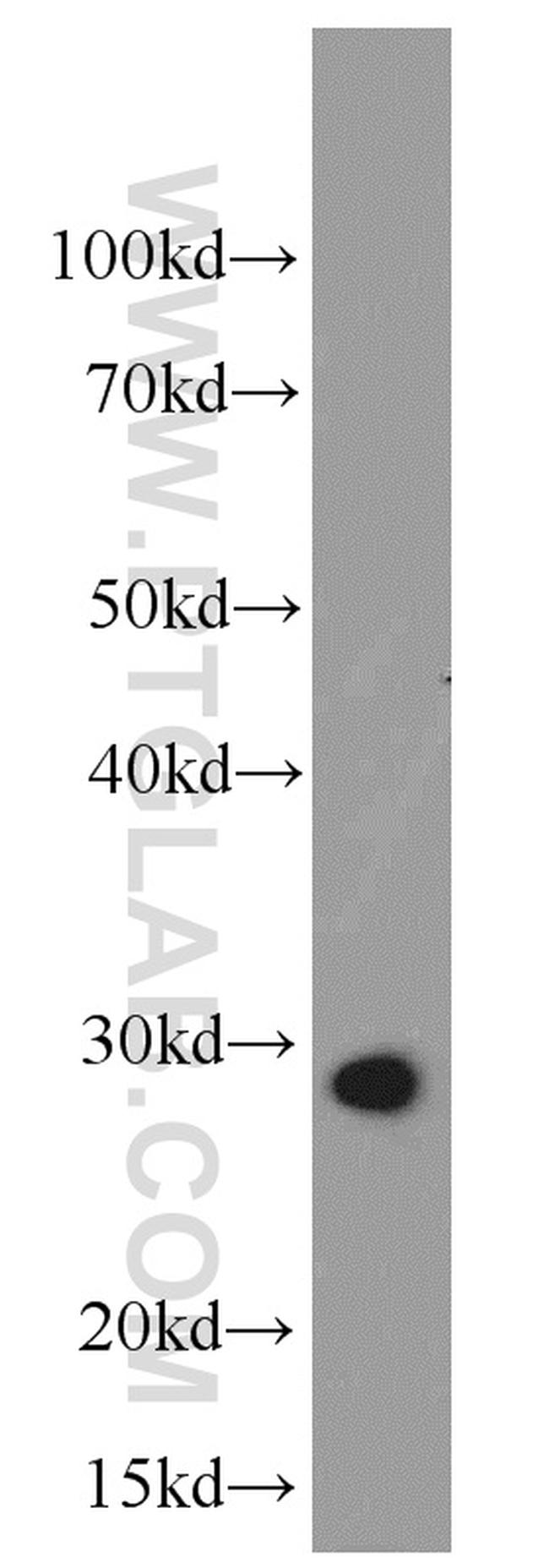 UCP2 Antibody in Western Blot (WB)