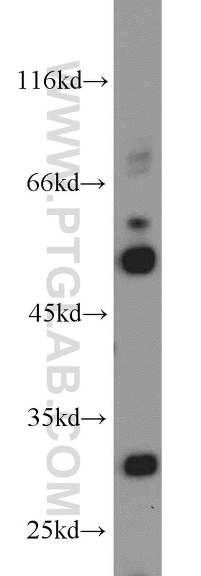 UCP2 Antibody in Western Blot (WB)