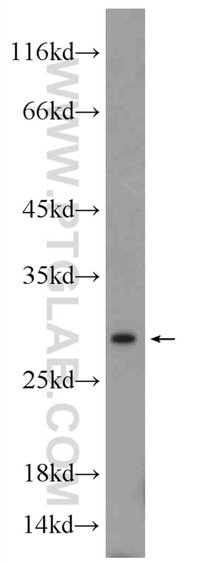 UCP2 Antibody in Western Blot (WB)