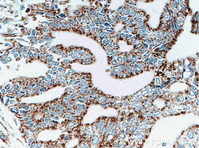 PPP1CC Antibody in Immunohistochemistry (Paraffin) (IHC (P))