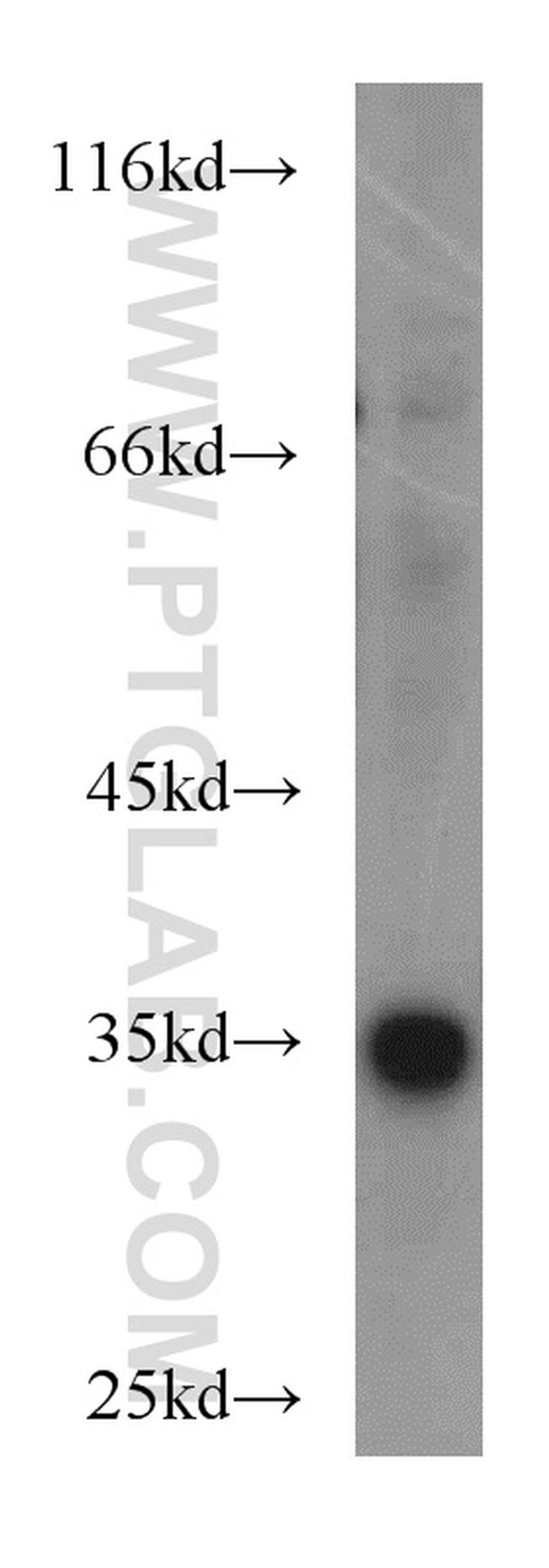 PPP1CC Antibody in Western Blot (WB)