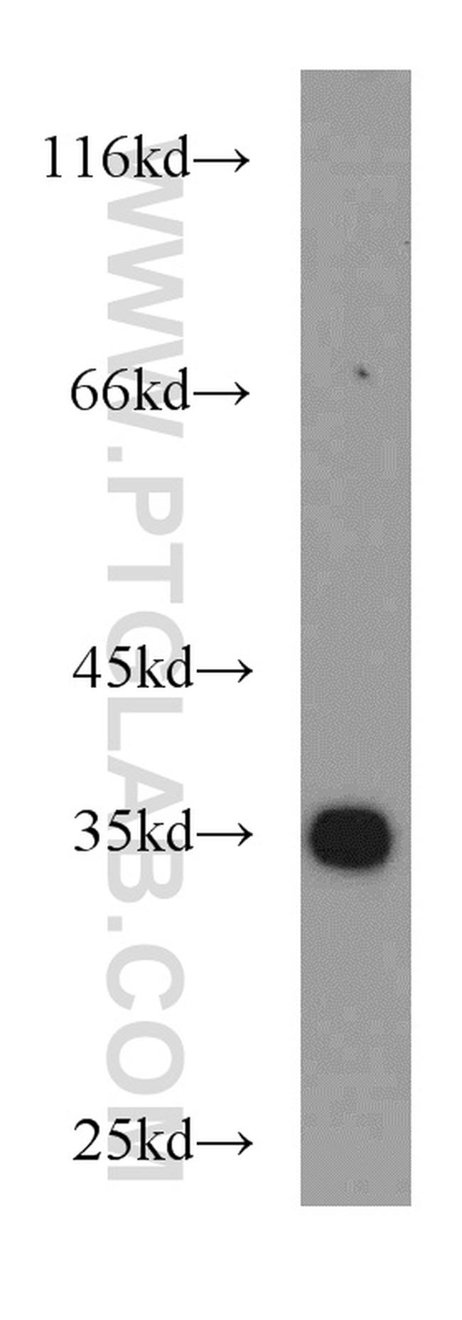 PPP1CC Antibody in Western Blot (WB)