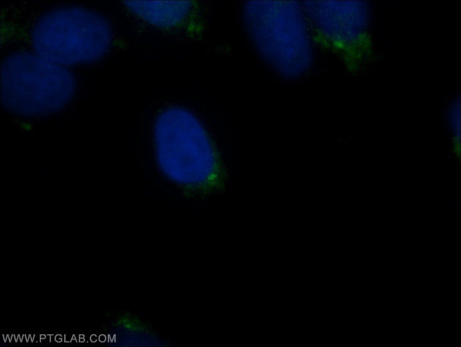 IFT57 Antibody in Immunocytochemistry (ICC/IF)