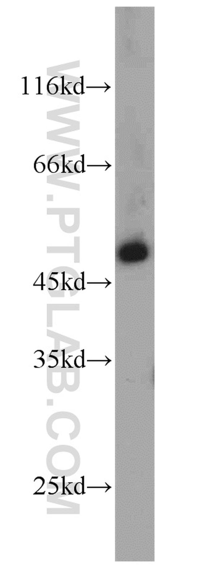 IFT57 Antibody in Western Blot (WB)