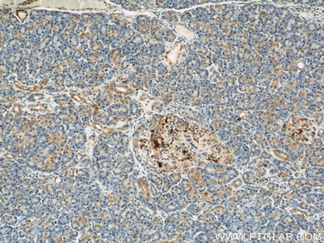 IFT57 Antibody in Immunohistochemistry (Paraffin) (IHC (P))