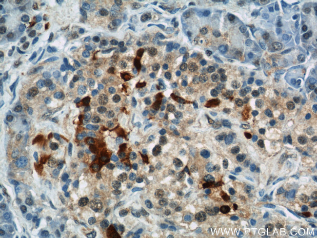 IFT57 Antibody in Immunohistochemistry (Paraffin) (IHC (P))