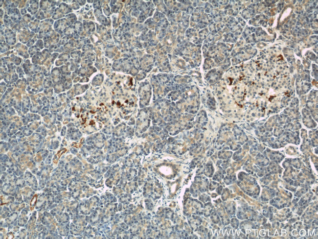 IFT57 Antibody in Immunohistochemistry (Paraffin) (IHC (P))