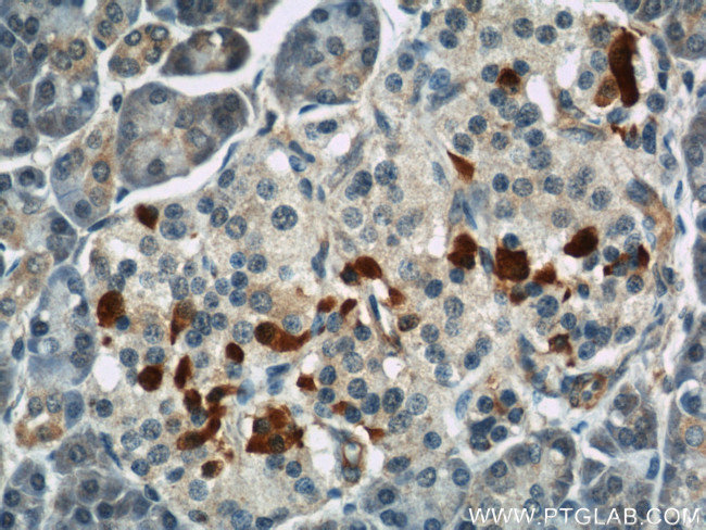 IFT57 Antibody in Immunohistochemistry (Paraffin) (IHC (P))