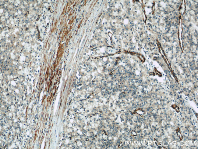 IFT57 Antibody in Immunohistochemistry (Paraffin) (IHC (P))