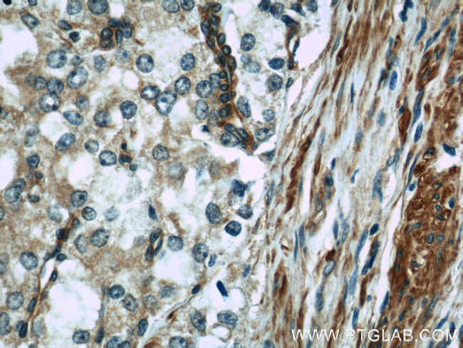 IFT57 Antibody in Immunohistochemistry (Paraffin) (IHC (P))