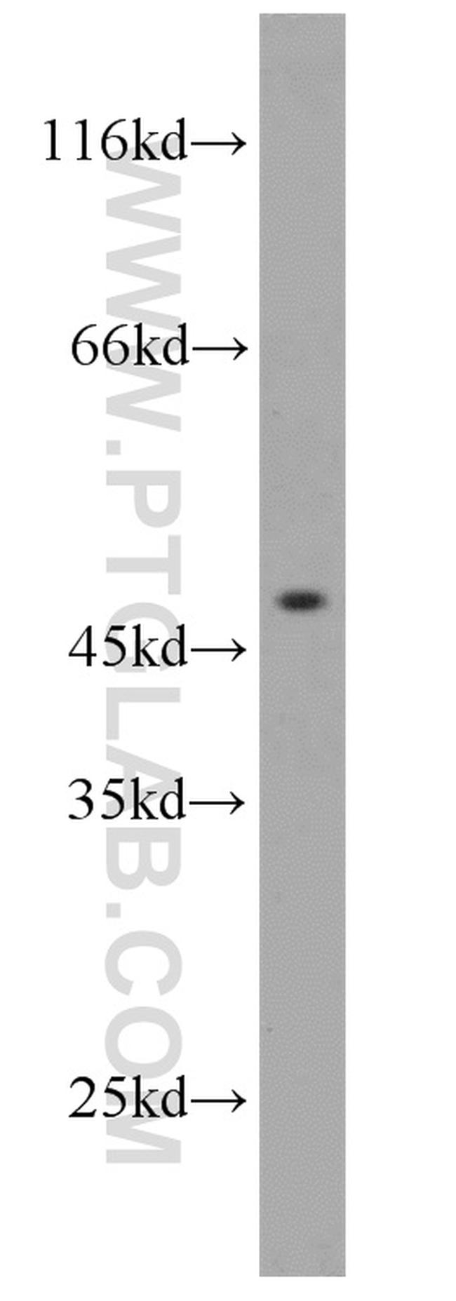 IFT57 Antibody in Western Blot (WB)