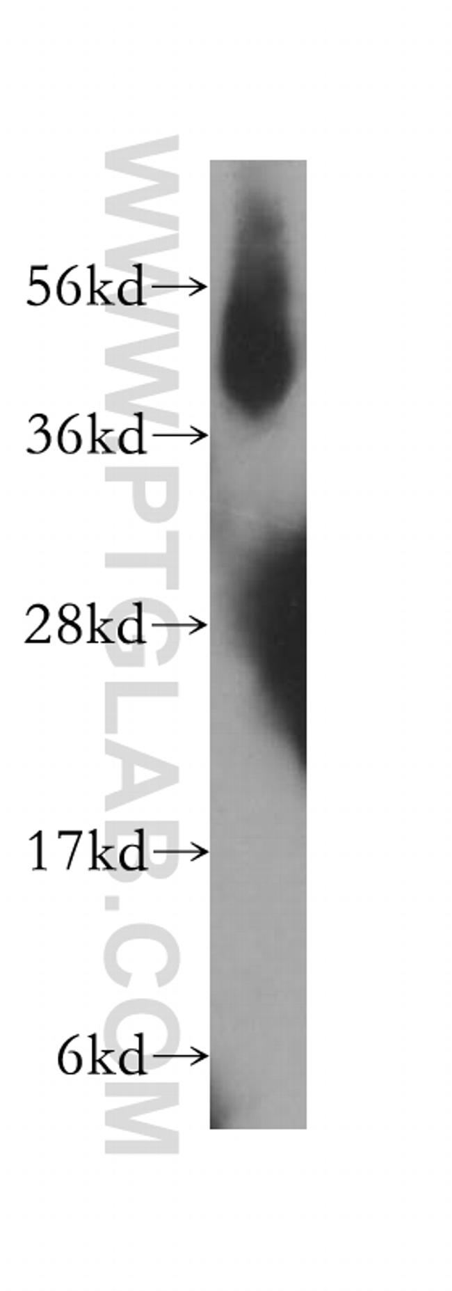 IFT57 Antibody in Western Blot (WB)