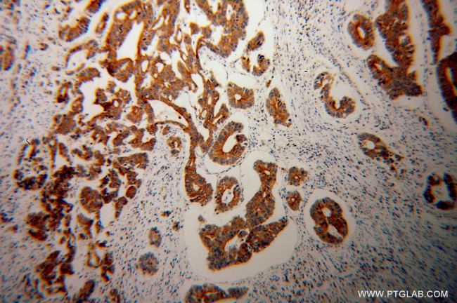 PARD3 Antibody in Immunohistochemistry (Paraffin) (IHC (P))