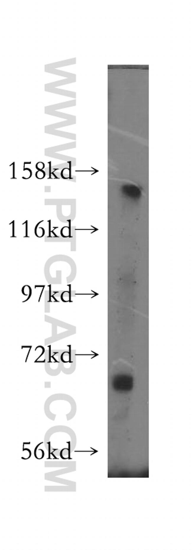 PARD3 Antibody in Western Blot (WB)