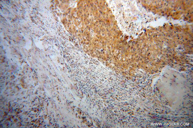 NME1 Antibody in Immunohistochemistry (Paraffin) (IHC (P))