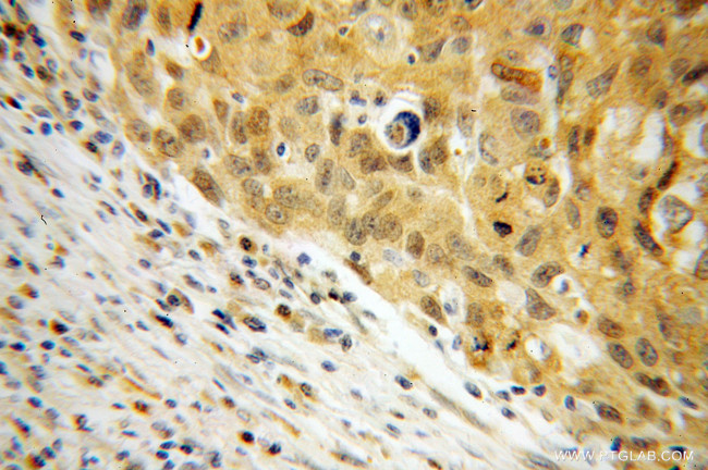 NME1 Antibody in Immunohistochemistry (Paraffin) (IHC (P))