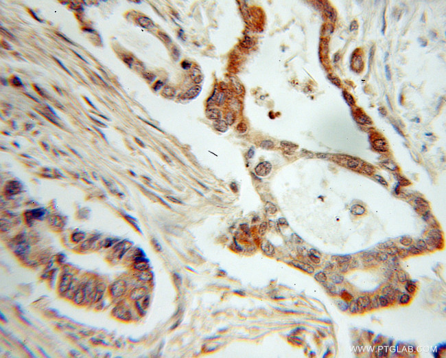 NME1 Antibody in Immunohistochemistry (Paraffin) (IHC (P))