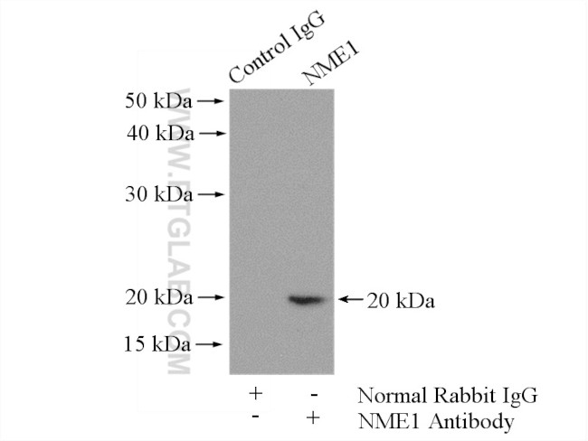 NME1 Antibody in Immunoprecipitation (IP)