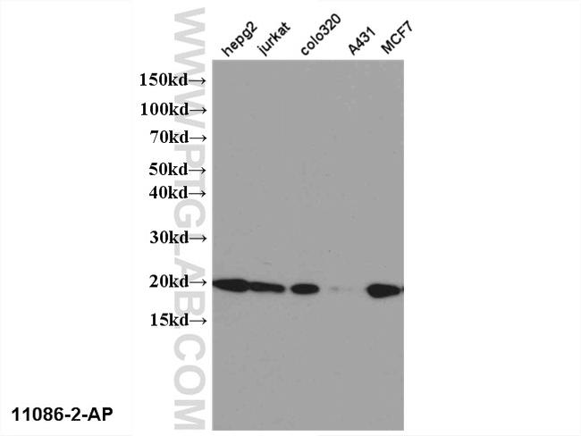 NME1 Antibody in Western Blot (WB)