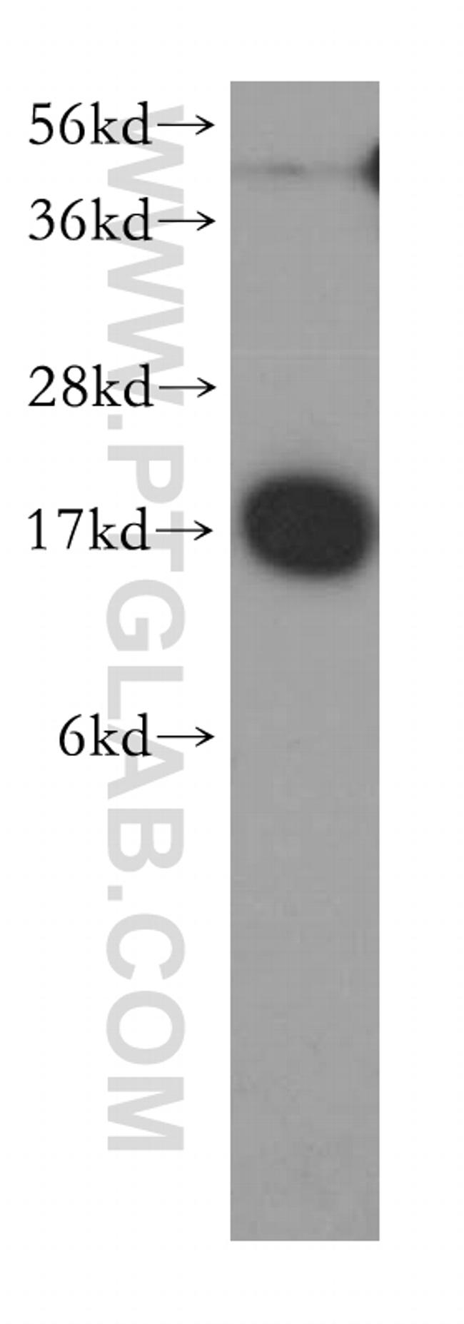 NME1 Antibody in Western Blot (WB)