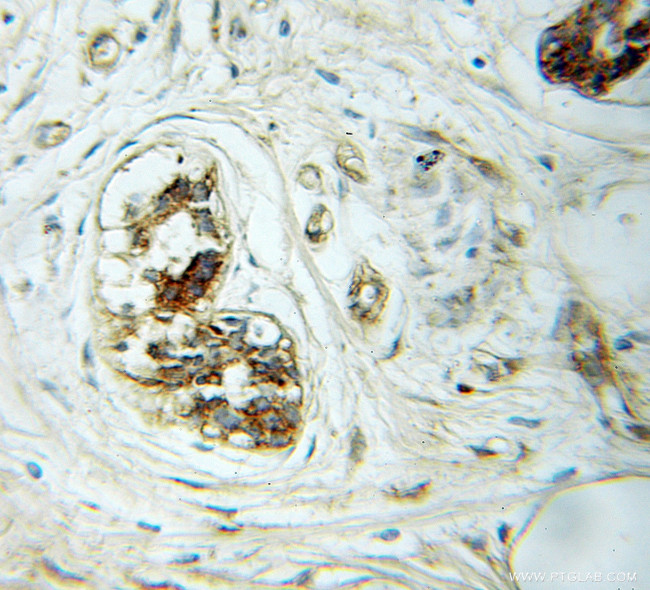 IRSp53 Antibody in Immunohistochemistry (Paraffin) (IHC (P))