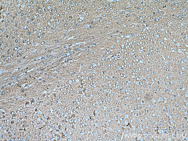 IRSp53 Antibody in Immunohistochemistry (Paraffin) (IHC (P))