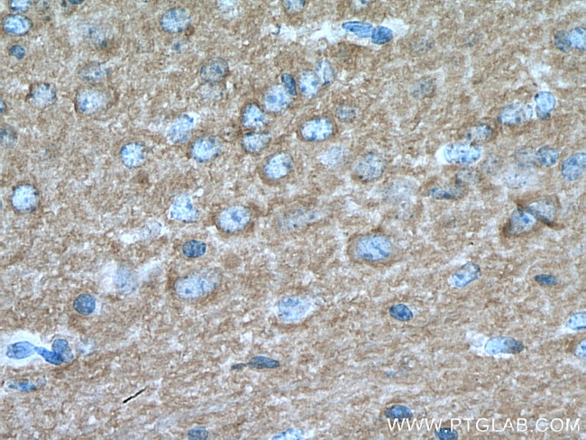 IRSp53 Antibody in Immunohistochemistry (Paraffin) (IHC (P))