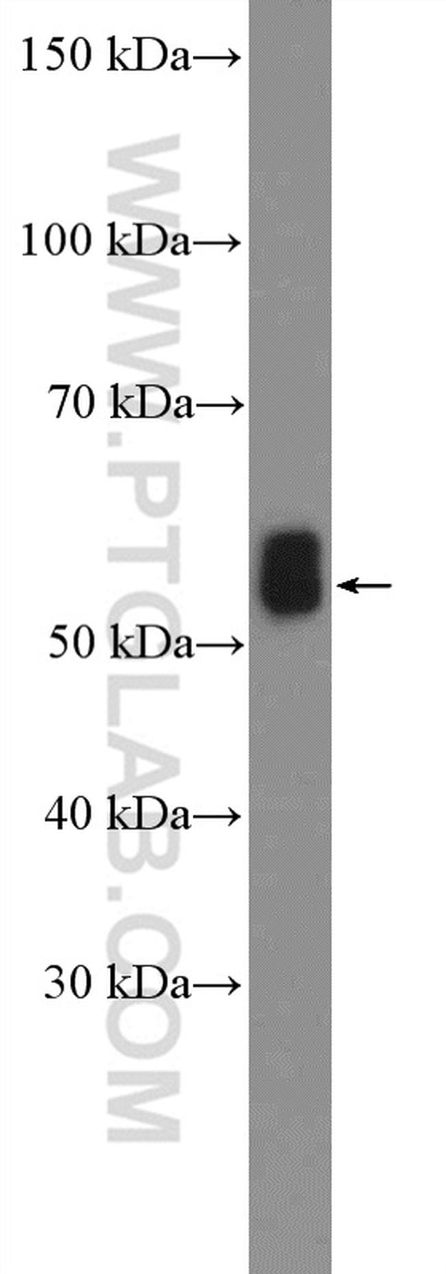 IRSp53 Antibody in Western Blot (WB)