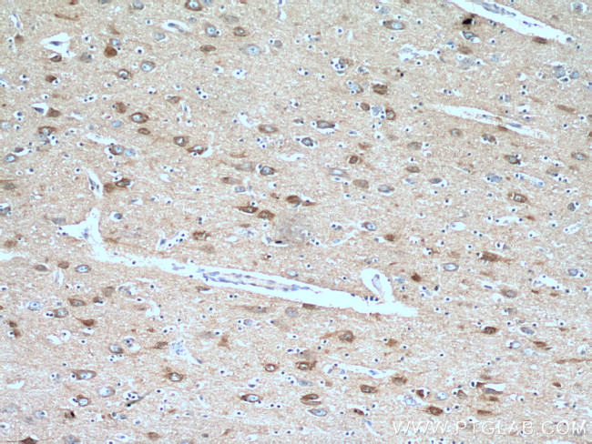 IRSp53 Antibody in Immunohistochemistry (Paraffin) (IHC (P))