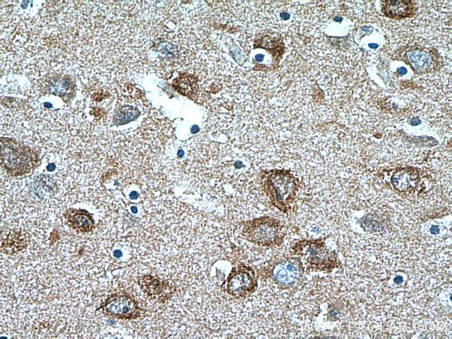 IRSp53 Antibody in Immunohistochemistry (Paraffin) (IHC (P))