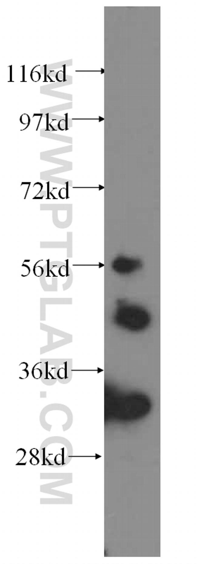 IRSp53 Antibody in Western Blot (WB)