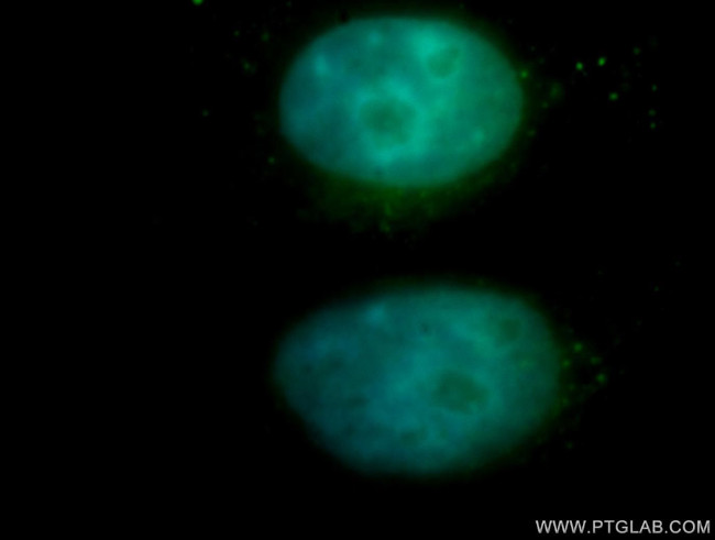 NFE2 Antibody in Immunocytochemistry (ICC/IF)