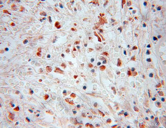 NFE2 Antibody in Immunohistochemistry (Paraffin) (IHC (P))