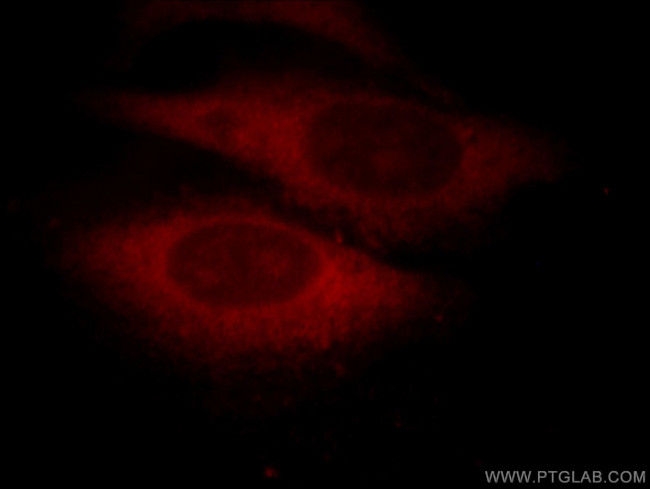 DNAJC7 Antibody in Immunocytochemistry (ICC/IF)