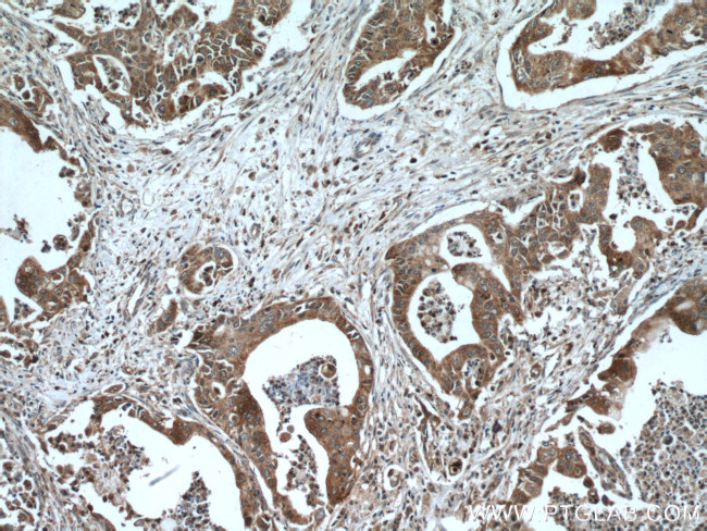 DNAJC7 Antibody in Immunohistochemistry (Paraffin) (IHC (P))