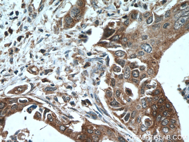 DNAJC7 Antibody in Immunohistochemistry (Paraffin) (IHC (P))