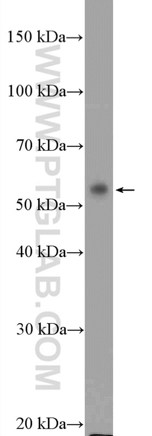 DNAJC7 Antibody in Western Blot (WB)