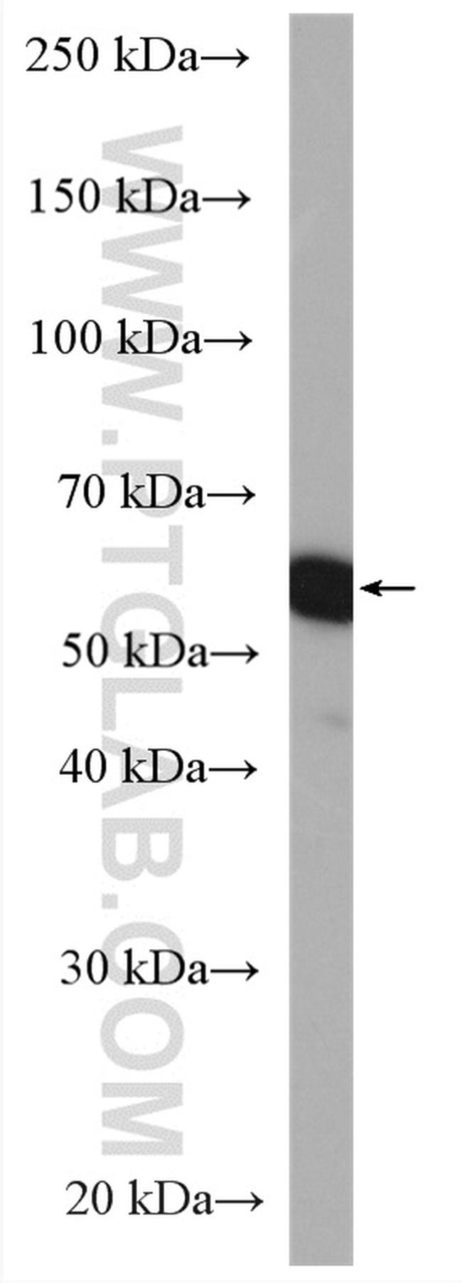 DNAJC7 Antibody in Western Blot (WB)