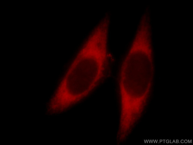 EMAP II Antibody in Immunocytochemistry (ICC/IF)