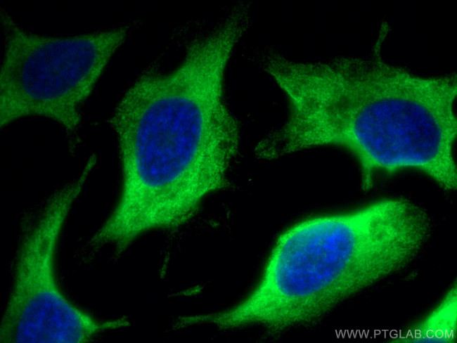 EMAP II Antibody in Immunocytochemistry (ICC/IF)