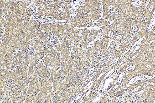 EMAP II Antibody in Immunohistochemistry (Paraffin) (IHC (P))