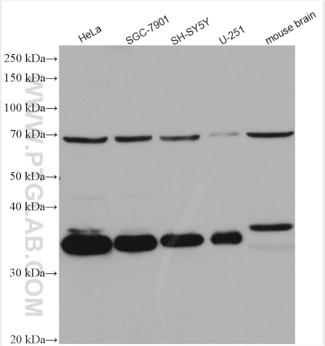 EMAP II Antibody in Western Blot (WB)