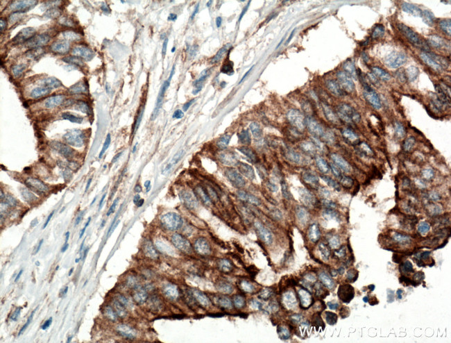 CCDC5 Antibody in Immunohistochemistry (Paraffin) (IHC (P))