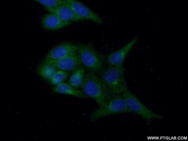 OSBP Antibody in Immunocytochemistry (ICC/IF)