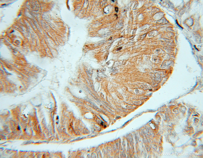 OSBP Antibody in Immunohistochemistry (Paraffin) (IHC (P))