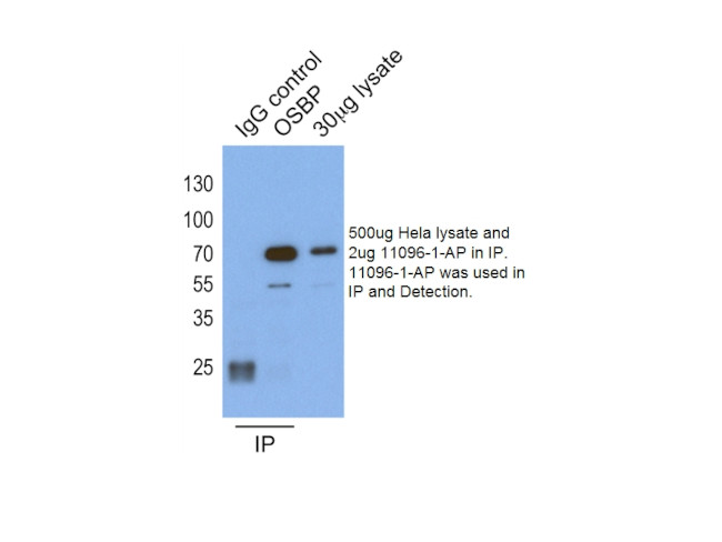 OSBP Antibody in Immunoprecipitation (IP)