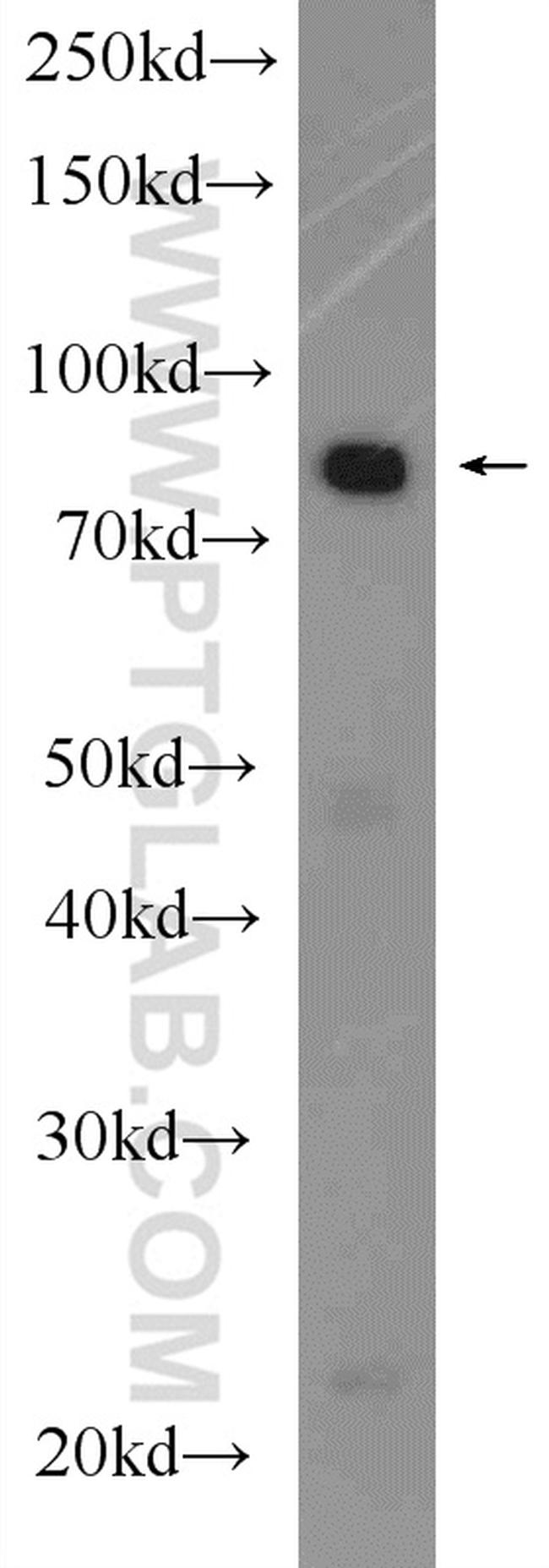 OSBP Antibody in Western Blot (WB)