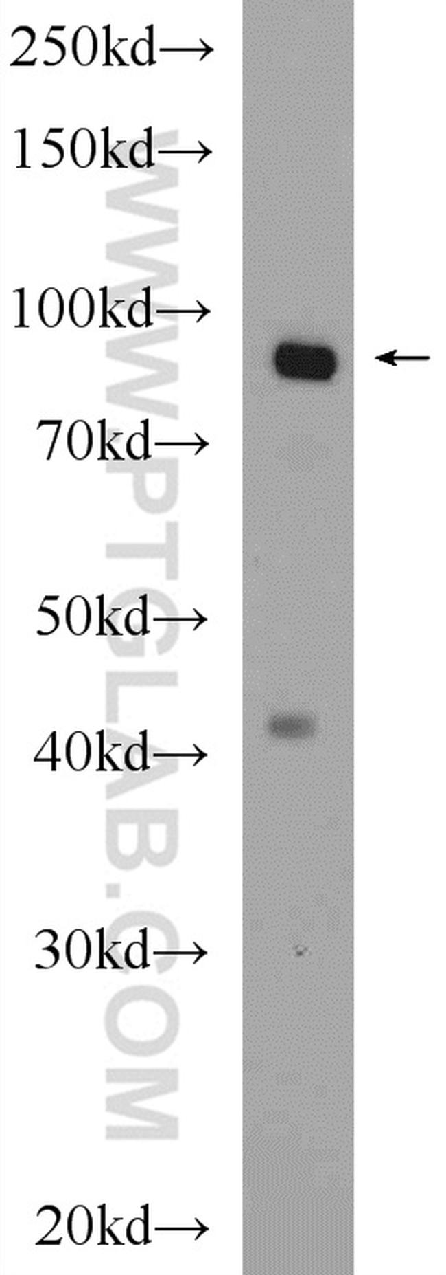 OSBP Antibody in Western Blot (WB)