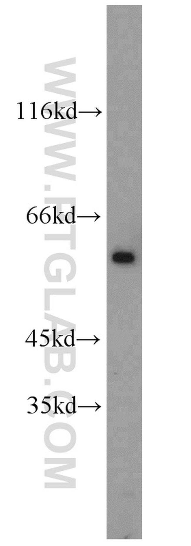 SRC Antibody in Western Blot (WB)